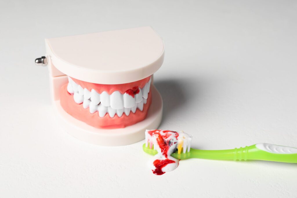 Dental model showing bleeding gums during brushing demonstration in Columbus, OH